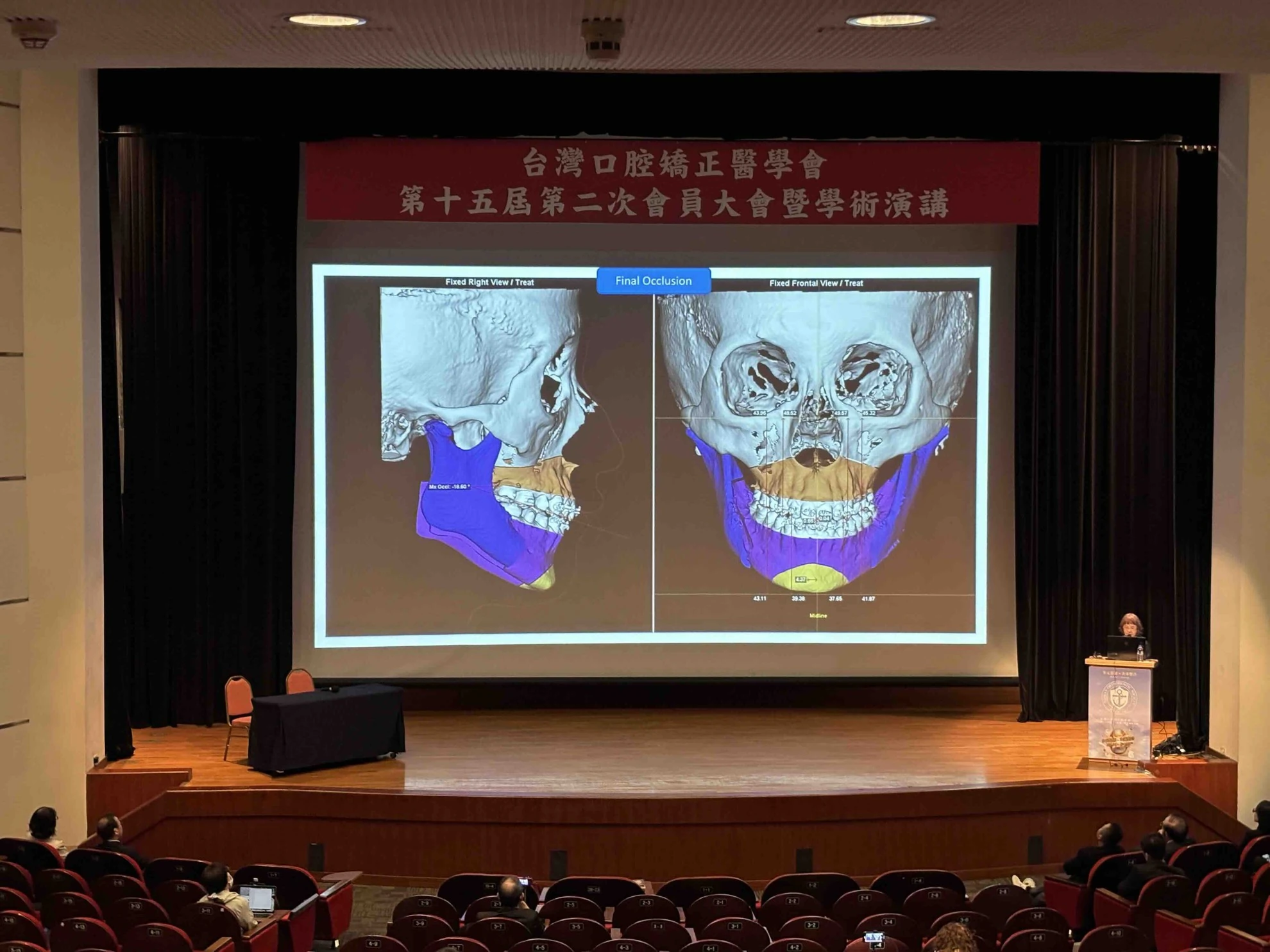 20260912_TOS數位正顎手術與數位隱形矯正的對話
