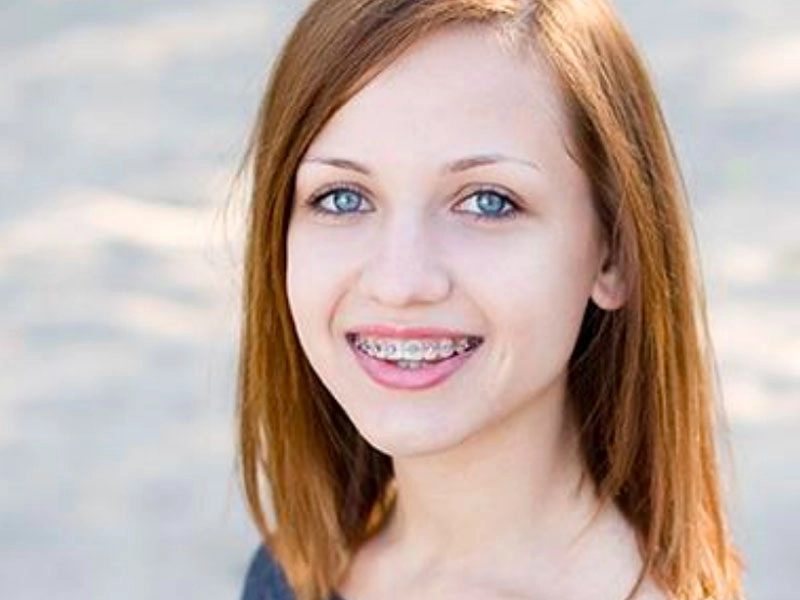 隱型矯正，孩子的需求美日牙醫懂