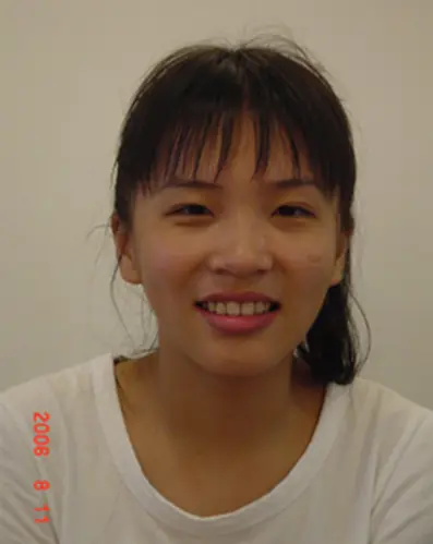 患者分享 - 呂Ｏ芸