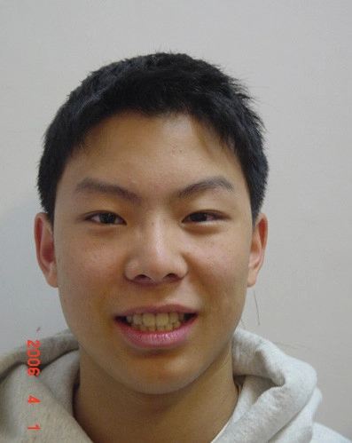 患者分享 - 彭Ｏ齊