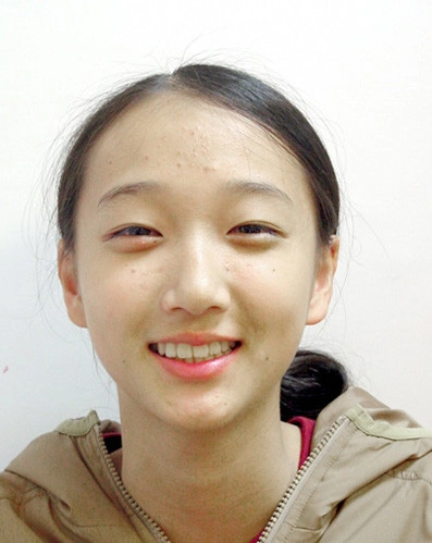 患者分享 - 曾Ｏ芬