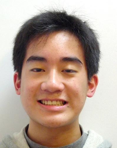 患者分享 - 溫Ｏ榮