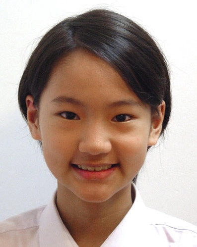 患者分享 - 邱Ｏ瑜 ( 13歲 )