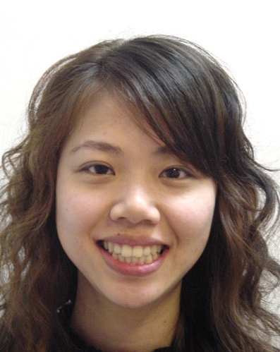 患者分享 - 張Ｏ芳