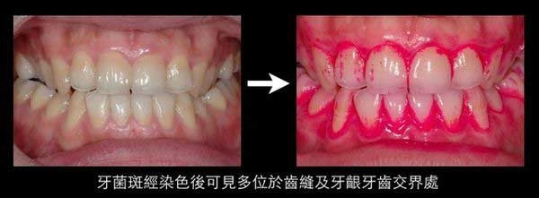 牙周病科 牙周病科