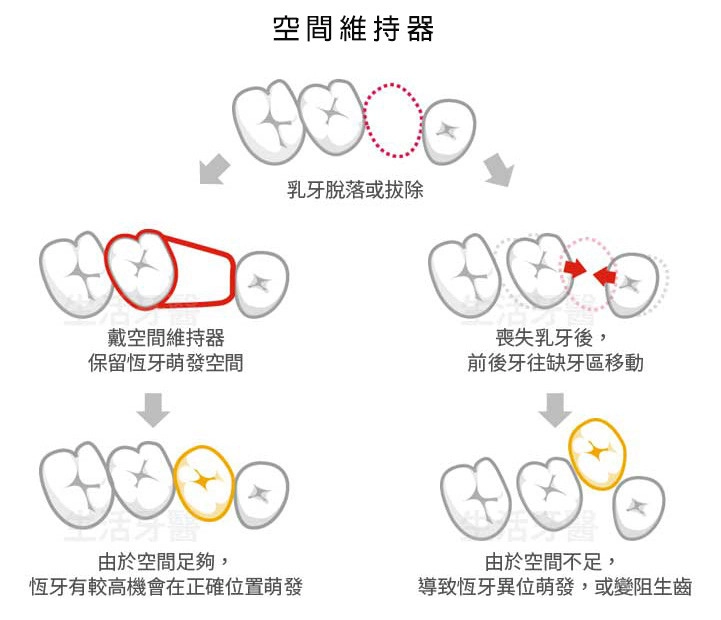 兒童牙科 兒童牙科