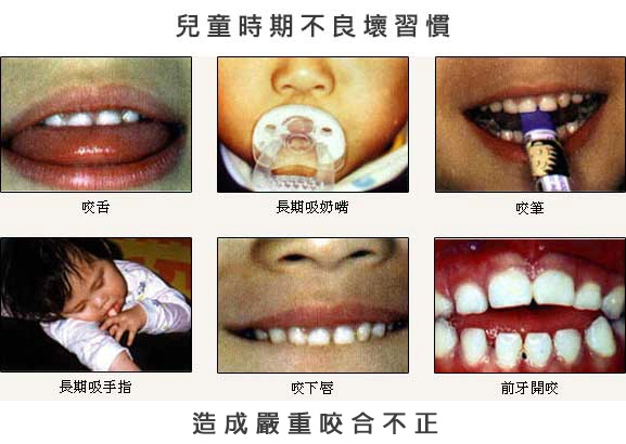 兒童牙科 兒童牙科