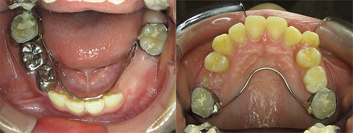 兒童牙科 兒童牙科