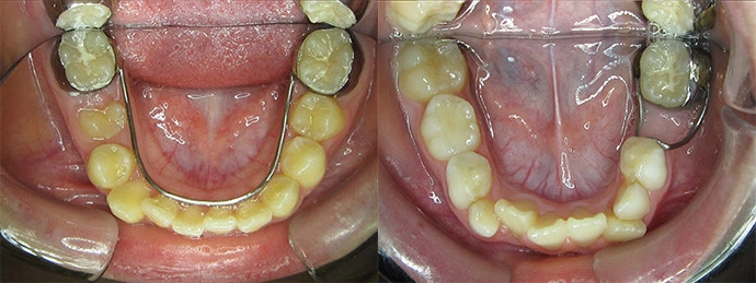 兒童牙科 兒童牙科